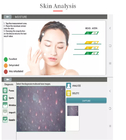 آنالیز دوربین HD 200X Skin Moisture Skin Care Analyzer OEM قابل حمل